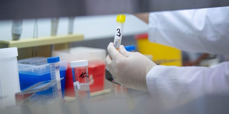 კორონავირუსის ახალი მაჩვენებელი საქართველოში – 5 ოქტომბრის სტატისტიკა