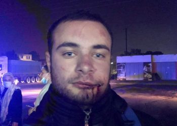 შსს-მ რუსთავში ოპოზიციის აქტივისტზე თავდასხმის საქმეზე 2 ადამიანი დააკავა