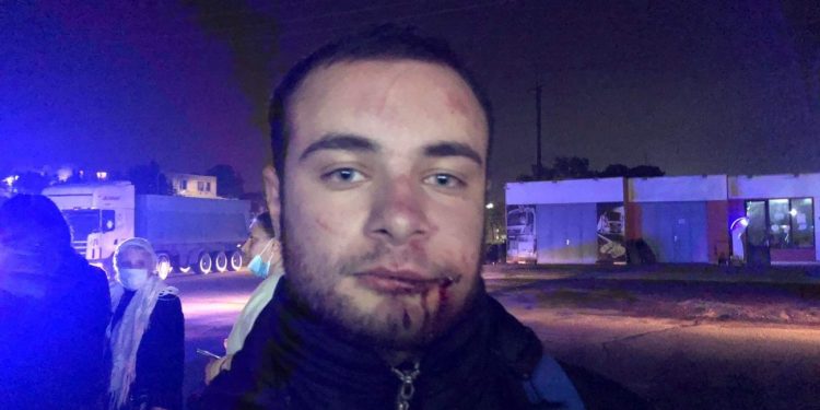 შსს-მ რუსთავში ოპოზიციის აქტივისტზე თავდასხმის საქმეზე 2 ადამიანი დააკავა