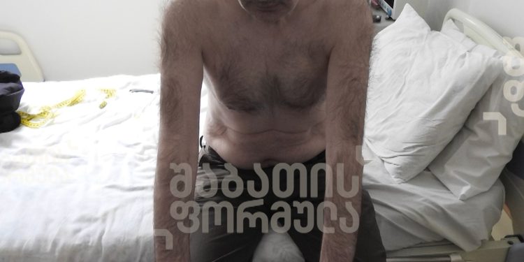 როგორ გამოიყურება მიხეილ სააკაშვილი [ფოტოები]