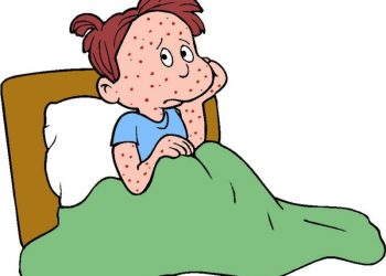 რიგ სამედიცინო დაწესებულებაში, ჩუტყვავილით ინფიცირებულთა მიმართვიანობამ მოიმატა