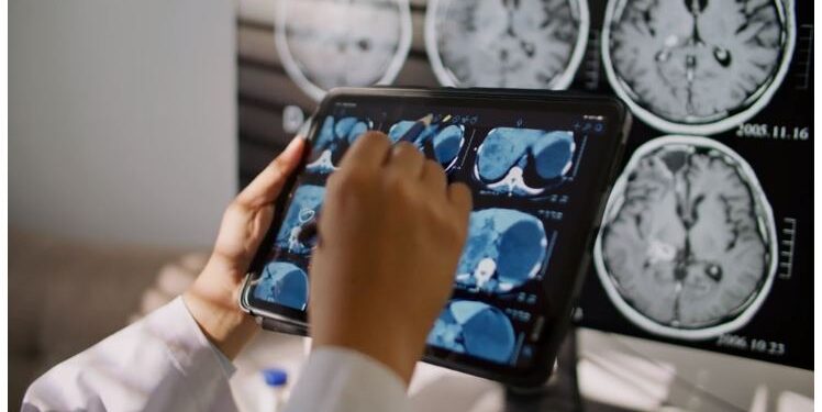 მეცნიერებმა სიმსივნის უჯრედების თვითგანადგურების პოტენციურ გზას მიაგნეს – კვლე­ვები