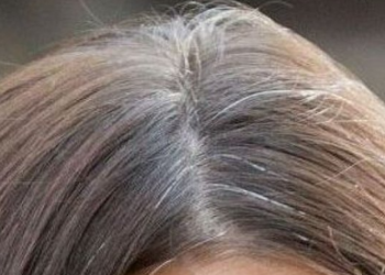 როგორ ავიცილოთ თავიდან ჭაღარა