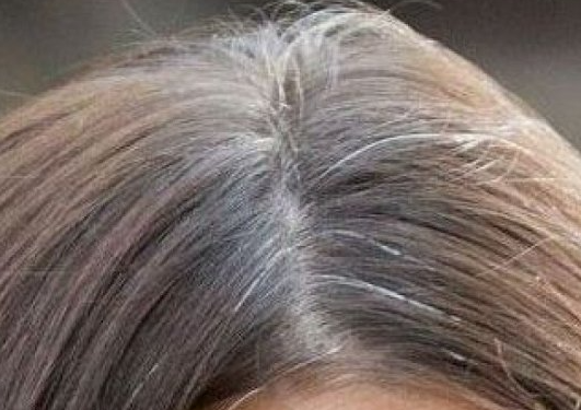 როგორ ავიცილოთ თავიდან ჭაღარა