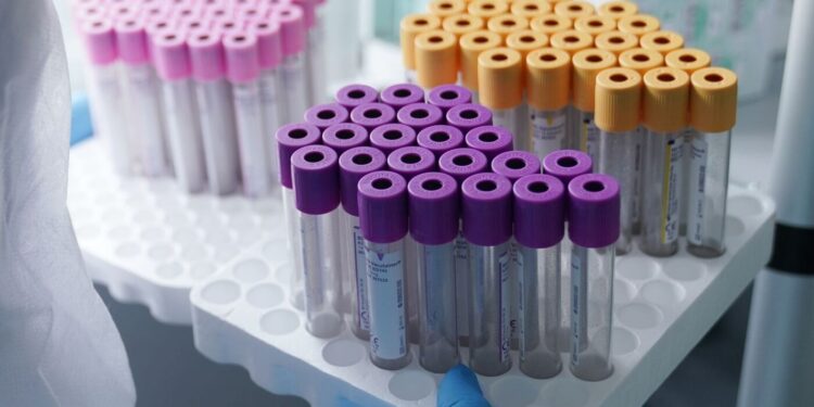 დაკავებულია ქალი, რომელსაც საქართველოში სინჯარებით კვერცხუჯრედები გადმოჰქონდა