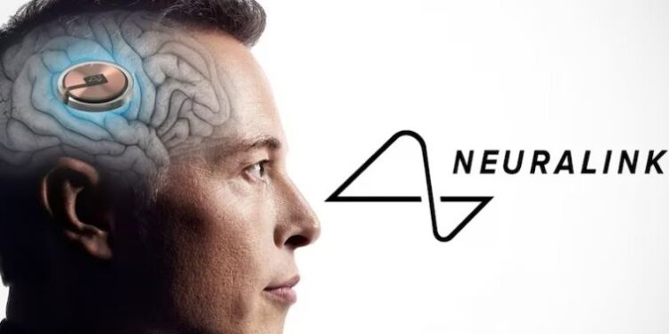 ილონ მასკის კომპანია Neuralink-მა ადამიანის ტვინში ჩიპის იმპლანტირების პირველი ოპერაცია განახორციელა