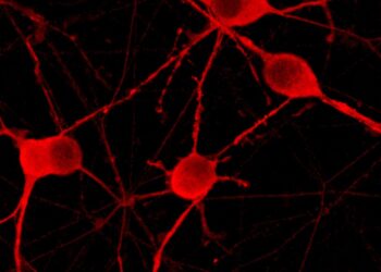 ჯანდაცვის წამყვანი პრობლემა ნევროლოგიური დაავადებები გახდა