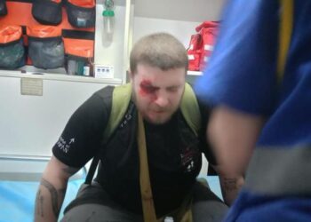 აქციის მონაწილეს, სავარაუდოდ, რეზინის ტყვია თვალში მოხვდა