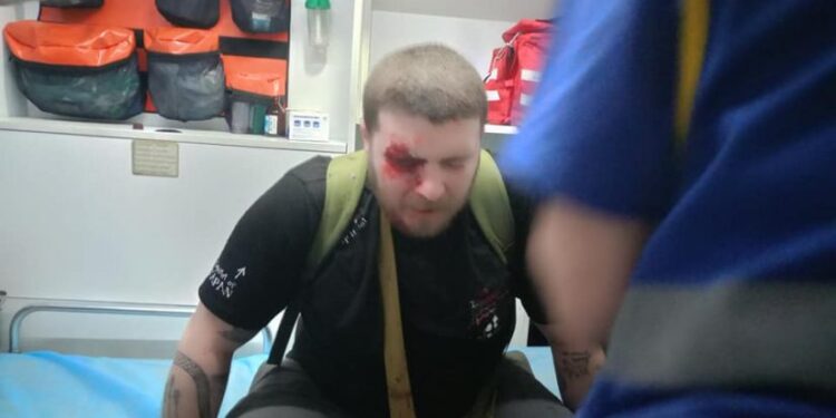 აქციის მონაწილეს, სავარაუდოდ, რეზინის ტყვია თვალში მოხვდა