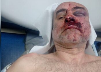 აქციაზე დავით ქაცარავას პოლიცია სასტიკად გაუსწორდა