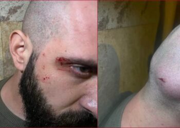 ზურაბ ჯაფარიძის ინფორმაციით, ბორის ჩელე ყურუას ფიზიკურად გაუსწორდნენ