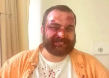 დიმიტრი ჩიქოვანს საკუთარ სახლთან თავს დაესხნენ