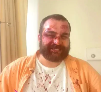 დიმიტრი ჩიქოვანს საკუთარ სახლთან თავს დაესხნენ