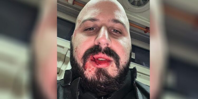 ორბორბლიანების მარშის ერთ-ერთ ორგანიზატორს თავს დაესხნენ