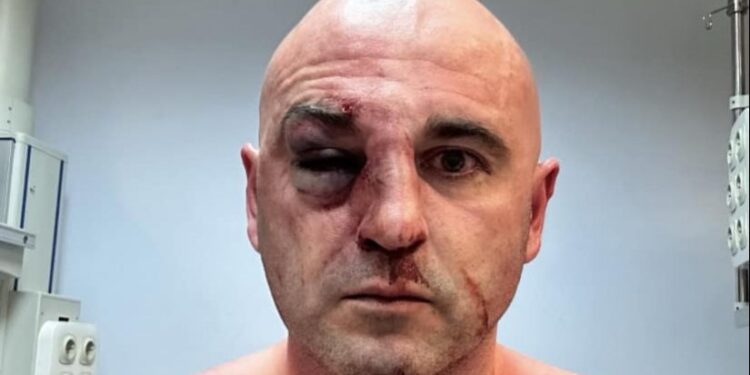 ენმ-ის თავმჯდომარე, ლევან ხაბეიშვილი ნაცემია