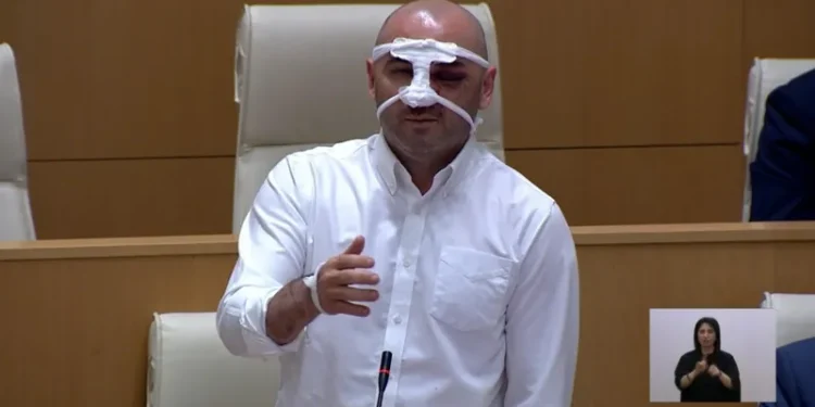 ლევან ხაბეიშვილი – როცა მირტყამდნენ მეუბნებოდნენ, „გრძელი ენა გაქვს, ხელისუფლებას მუდმივად აკრიტიკებ, იქნებ გაჩერდე“