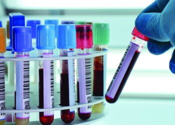 რა გამოკვლევები უნდა ჩაიტაროს 50 წელზე უფროსი ასაკის პაციენტებმა ყოველწლიურად