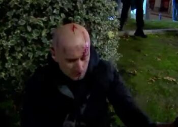 აქციის დაშლის დროს ფორმულას ჟურნალისტს სპეცრაზმელი თავს დაესხა და თავში ჩაარტყა