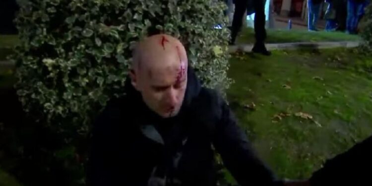 აქციის დაშლის დროს ფორმულას ჟურნალისტს სპეცრაზმელი თავს დაესხა და თავში ჩაარტყა