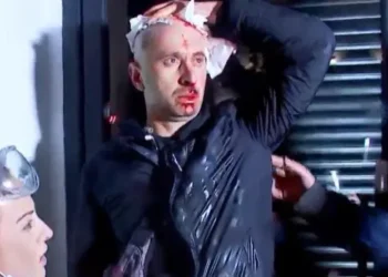 ექიმის განცხადებით, ჟურნალისტ გურამ როგავას აქვს სახის ძვლების მოტეხილობა, ასევე კისრის მე-7 მალის რკალის მოტეხილობა