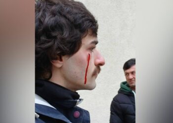 დაპირისპირება პროფკავშირებში – დაშავებულია 3 ადამიანი