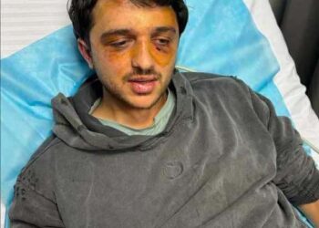 ოზურგეთელი დათა ხარაიშვილი გუშინდელ აქციაზე პოლიციელებმა სცემეს – ის კლინიკაშია გადაყვანილი