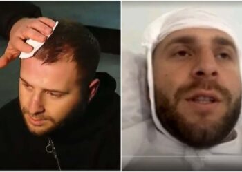 ვიდეო – “ჩვენზე თავდასხმიდან 48 საათია უკვე გასული და არც ნივთმტკიცებები წაუღია პოლიციას, რომელიც სახლში მიდევს და არც დავკითხულვარ” – გიორგი შეწირული, “TV პირველის” ოპერატორი.