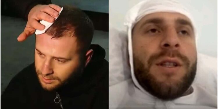 ვიდეო – “ჩვენზე თავდასხმიდან 48 საათია უკვე გასული და არც ნივთმტკიცებები წაუღია პოლიციას, რომელიც სახლში მიდევს და არც დავკითხულვარ” – გიორგი შეწირული, “TV პირველის” ოპერატორი.