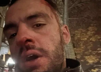 მსახიობ გიორგი მახარაშვილს ფიზიკურად გაუსწორდნენ