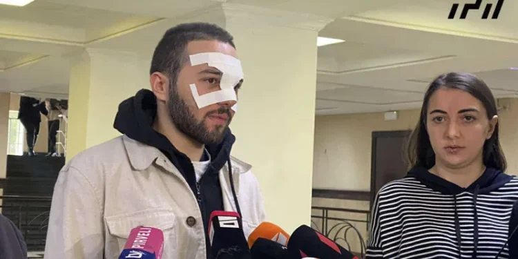 ”სპეცრაზმელმა სახეში წიხლი ამომარტყა და ცხვირი გამიტყდა – საპირფარეშოში შემიყვანეს, ტუალეტის ქაღალდი მომიტანეს, ამით გაიჩერე სისხლიო” – აქციაზე დაკავებული დავით გოგილაშვილი
