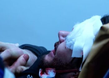 აქციის ძალადობრივი დაშლისას დაშავებული 22 წლის ალექსი თირქიას მდგომარეობა კვლავ სტაბილურად მძიმეა