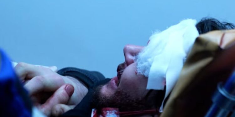 აქციის ძალადობრივი დაშლისას დაშავებული 22 წლის ალექსი თირქიას მდგომარეობა კვლავ სტაბილურად მძიმეა