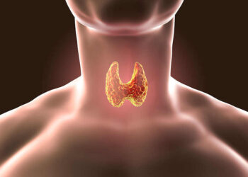 თუ ფარისებრ ჯირკვალში კვანძები აღმოჩნდა – რა გავაკეთოთ?