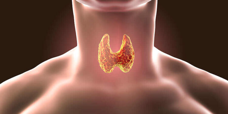 თუ ფარისებრ ჯირკვალში კვანძები აღმოჩნდა – რა გავაკეთოთ?