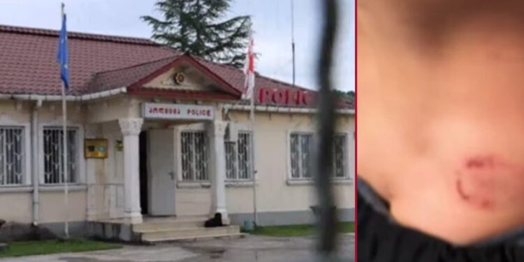 7 წლის ბავშვზე ძალადობის ბრალდებით დედა და ბებია დააკავეს