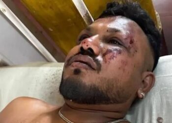 რას ჰყვება ინდოეთში, ავიაკატასტროფის დროს სასწაულებრივად გადარჩენილი ერთადერთი მგზავრი