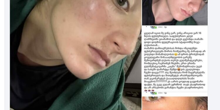 ქალთა საფეხბურთო კლუბი “ლანჩხუთი” სპეციალურ განცხადებას ავრცელებს