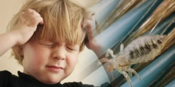 ტილების მოსაშორებელი ყველაზე ეფექტური მეთოდები, რომლებიც ბავშვებთან გამოგადგებათ: “კლავს როგორც ზრდასრულ ტილებს, ისე კვერცხებს”