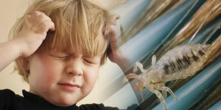 ტილების მოსაშორებელი ყველაზე ეფექტური მეთოდები, რომლებიც ბავშვებთან გამოგადგებათ: “კლავს როგორც ზრდასრულ ტილებს, ისე კვერცხებს”