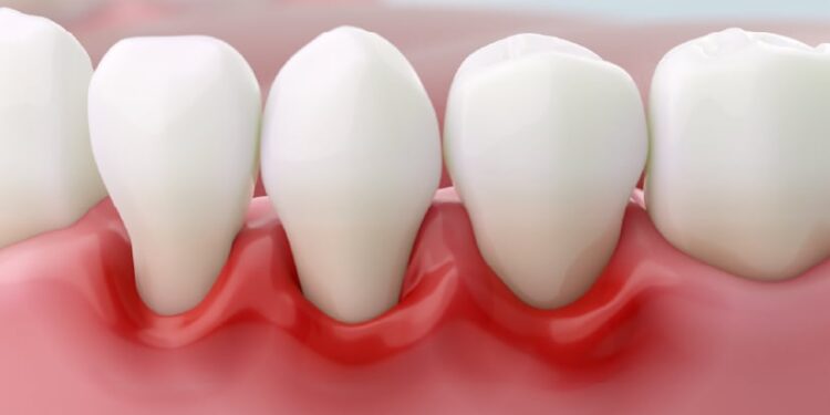 კარიესის მკურნალობა: ინოვაციური მიდგომები და უმტკივნეულო შედეგი