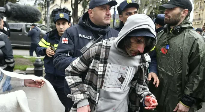 “პროვოკატორები და გადაცმული პოლიციელები შემოყარეს” – ხმაური და დაპირისპირება პარლამენტთან. აქტივისტების ცნობით, პოლიციამ ერთი პირი დააკავა